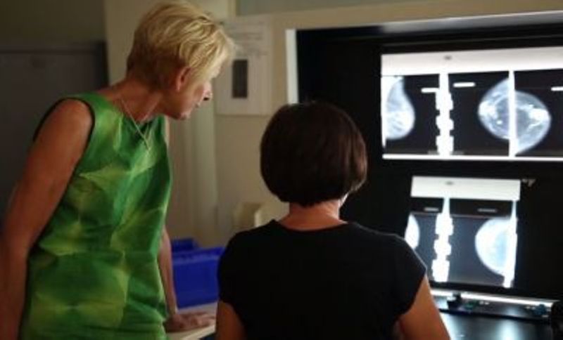 Le dépistage organisé du cancer du sein en PACA.